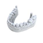 Gray Biocompatible 3d Printing Resin Dentures Biocompatible Uv Resin