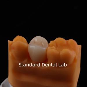 Wholesale Full Contour Zirconia Crown Exceptional Strength and Esthetics No Porcelian Overlay Posterior Crown China Dental Lab from china suppliers