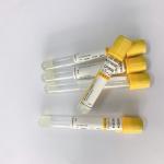 Professional Serum Clot Activator Tubes Separation Yellow Cap vacuum blood