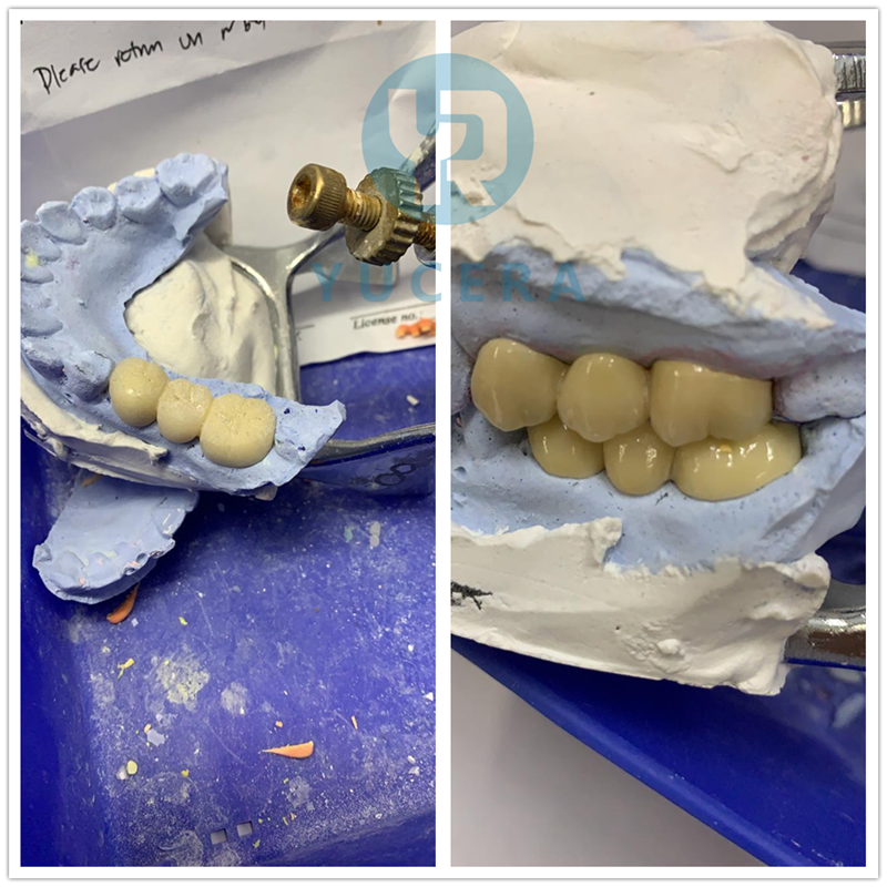 ISO CE Approved Dental Zirconia Block Full Zirconia Crown Block