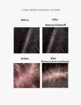Gel Form Sea Salt Shampoo Cream for Clearing Hair Anti-Dandruff Anti-Itch Oil