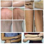 Most Sell Product 2 in 1 Picosecond Tattoo Removal Diode Hair Removal 755 808