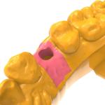 Biomimetic Gingival Photosensitive Resin Surgical Training Models Gum Resin