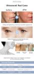 2 In1 Facial Lifting Eye Bags Removal Machine Ultra Radio Frequency Collagen