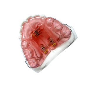 Wholesale High Hardness FDA Functional Appliance Orthodontic Rubber Retainer from china suppliers