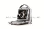 Top Sale Laptop Ophthalmic AB Mode Ultrasound Scanner Equipment