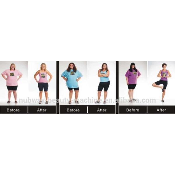 Prtable Cryo fat loss slimming machine 2 handle working at same time with -15 degree