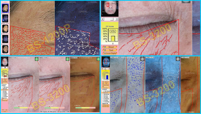 8800 Lux Skin Analysis Machine / Hair And Skin Analyzer For Dermal Skin Analysis