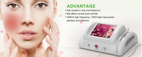 High Frequency Vascular Beauty Spider Vein Removal Machine RBS 100