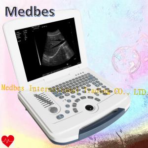 Wholesale Hospital 15 TFT Color Medical Portable Ultrasound Machine from china suppliers