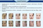 Factory price best selling salon used imported Germany lamp IPL hair removal