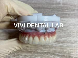 China Screw Implant Digital Dental Crowns And Bridge Scheftner Ivoclar Translucency on sale