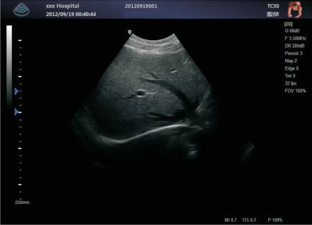 Portable Full Digital Color Doppler Ultrasound System Medical Scanner Ultrasound