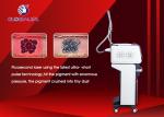 Medical Picosecond ND YAG Laser Machine Portable Tattoo Removal Machine