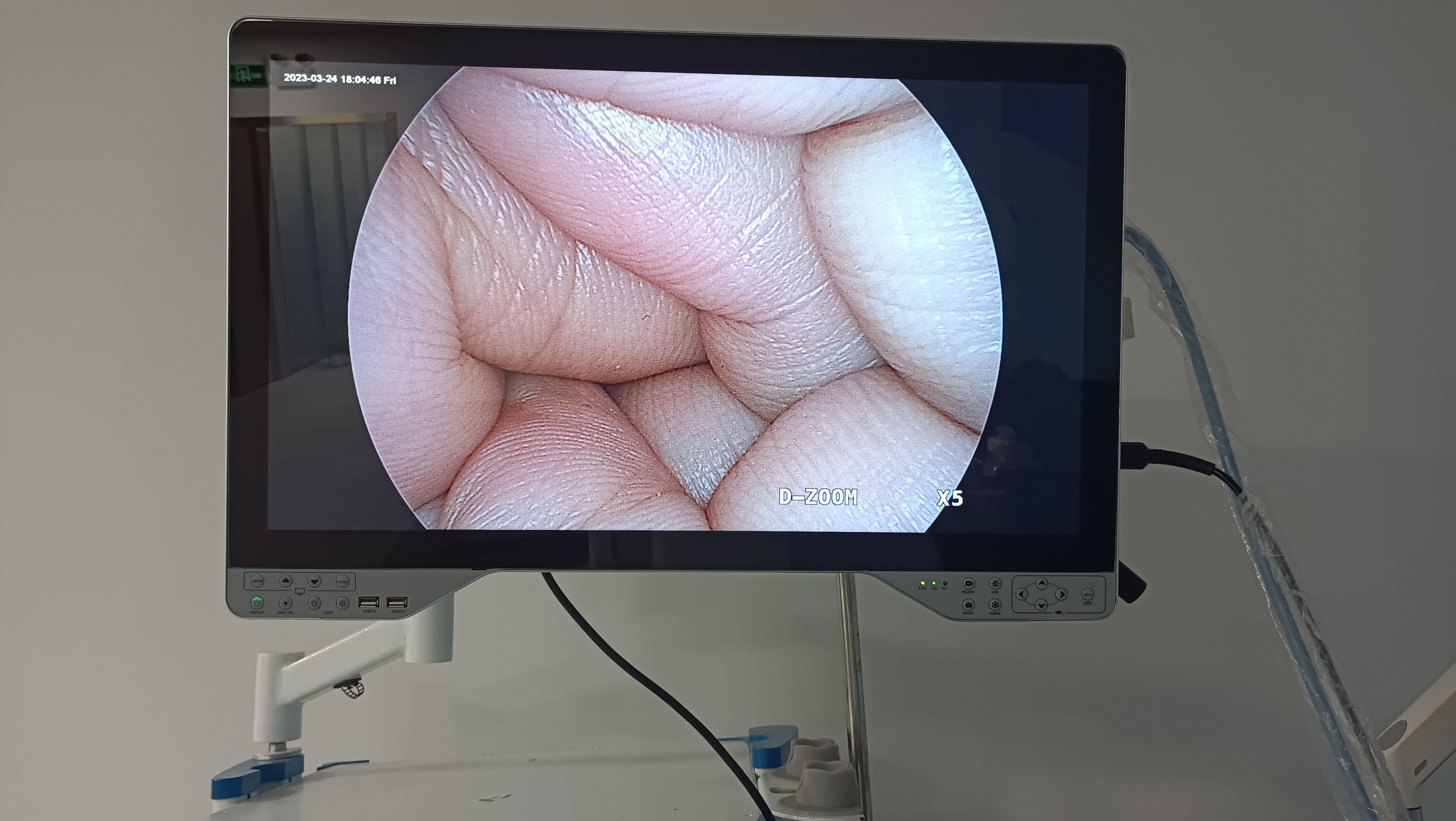 1/2.8" SONY CMOS Sensor Full HD Endoscopic Camera for Veterinary Surgery Equipment
