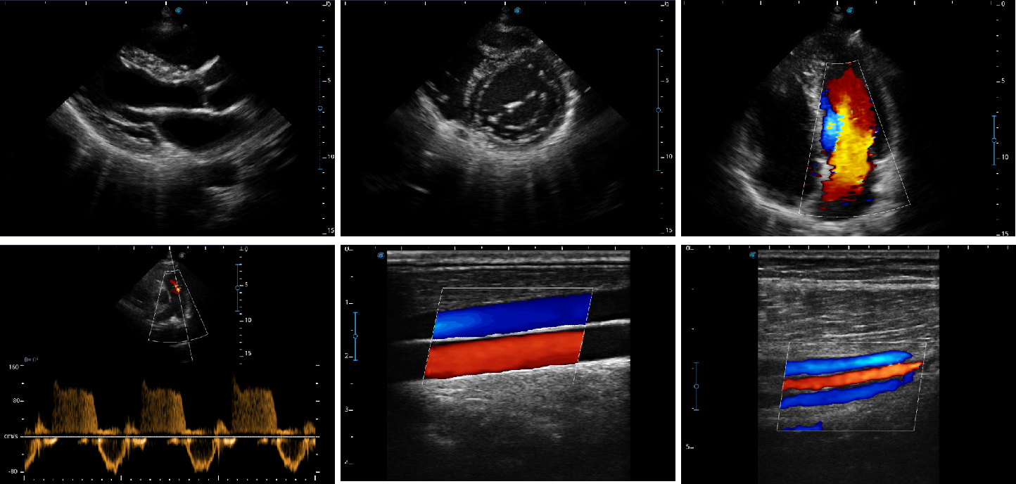 Sonoscape X5 Medical Ultrasound Instruments Machine with Excellent Image Quality