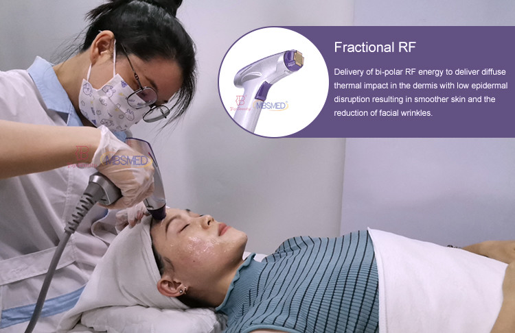 Rf Fractional Microneedle Rf Face Lifting Anti Wrinkle Machine