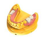 Biocompatible Invisible Denture Base Resin Dental Resin