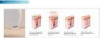 NUBWAY Diode laser hair removal/ 808nm Diode laser Depilation/ 808nm diode laser