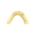 Temporary Crown Biocompatible Resin Dental Bridge Photosensitive Resin