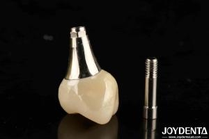 Wholesale Biocompatible Dental Implant Crown And Bridge Aesthetically Pleasing For Safe Oral from china suppliers