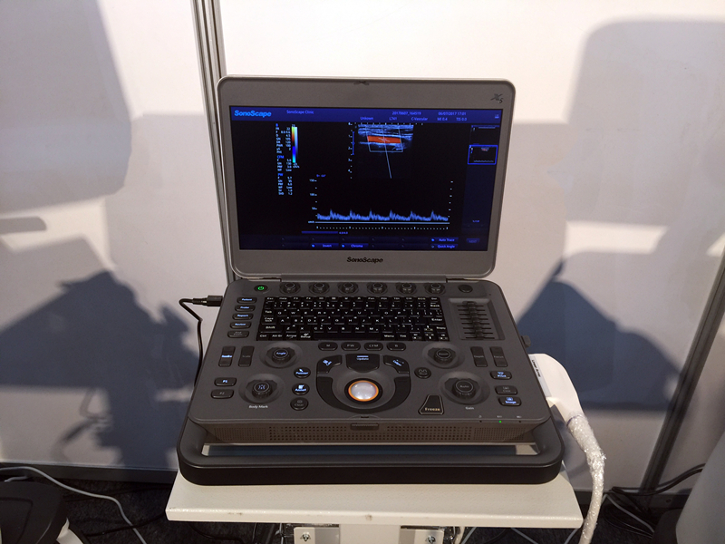 Sonoscape X5 Medical Ultrasound Instruments Machine with Excellent Image Quality