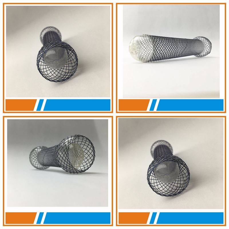 Efficaciousand Safe Expandable Metal Esophageal Stents with Ni-Ti alloy wire