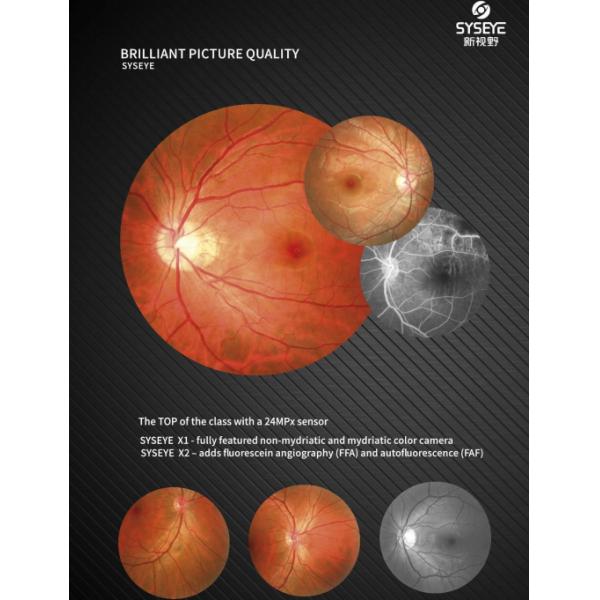 Automated Fundus Camera with Images and Multimodal Imaging Options for Small Pupil Imaging and Easy Operation
