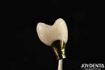 Various Sizes Implant Crown And Bridge For Strong Dental Implants Compatibility