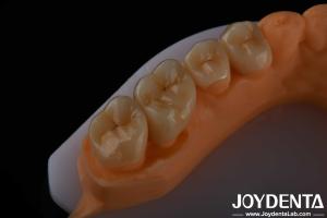 Wholesale High Aesthetics Full Contour Zirconia For Crowns Bridges Implants Dental Restorations from china suppliers