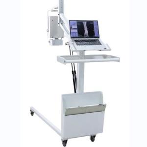 Wholesale High Frequency Mobile Digital Radiography Machine Digital X Ray Equipment from china suppliers