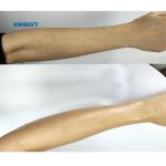 755 808 1064nm OEM Diode Laser Hair Removal Device for Ozero Khanka Pioneer