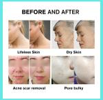 Pdt Change Silicone Red Light Therapy Mask 7 Led Colors Skin Care Face