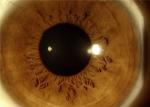 10 Times Magnification 16MP Ophthalmology Equipment