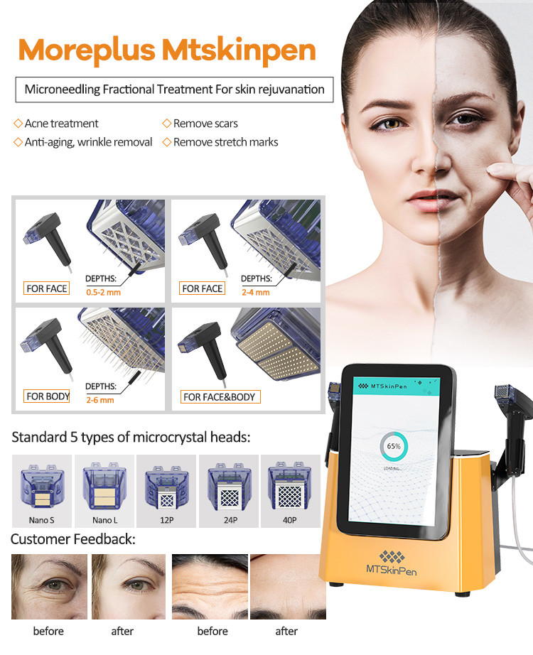 Highly Effective RF Microneedling Machine Scar Removal Stretch Removal Body And Face