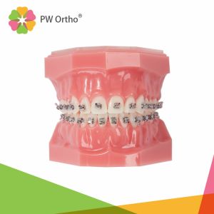 China Easy Ligation Orthodontic Passive Self Ligating Brackets Damon Style on sale