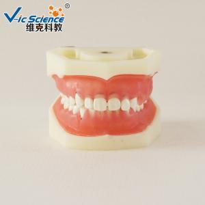 Wholesale Professional Medical Dental Study Models VIC-L5 Peridontal Disease Model from china suppliers