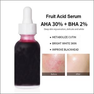 Wholesale MSDS OEM Skin Care Products Neutral AHA Fruit Acid Liquid Softens Cuticles Removes Acne Blackheads Facial Essence from china suppliers