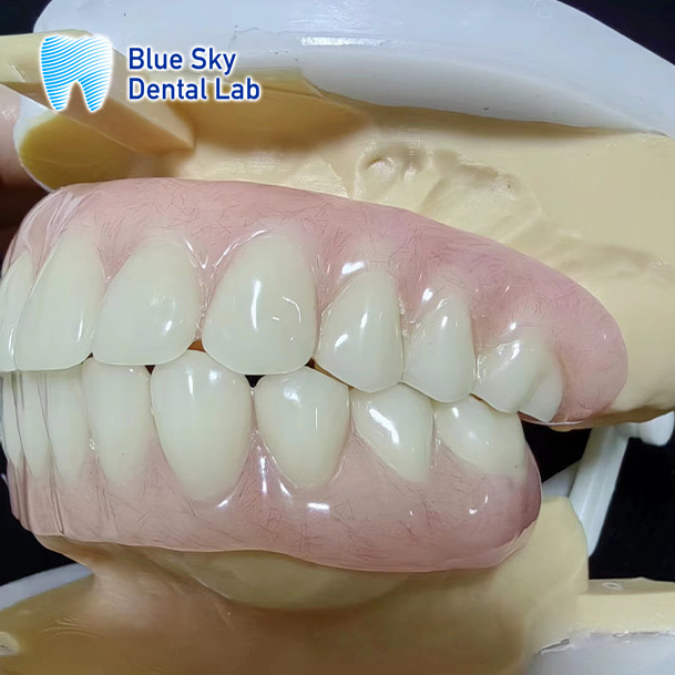 Natural Looking Removable Valplast Partial Dentures For Upper Anterior And Posterior Teeth