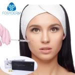 Cross Linked Hydrochloric Acid Lip Filler Transparent Gel 1ml Non Surgical