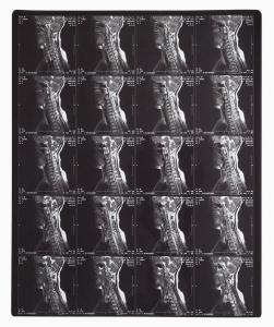 Wholesale Blue Radiological Imaging Laser Film For Thermal Print Laser Image Printer from china suppliers
