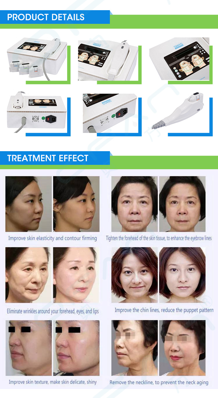 Inewtech Ultrasound Hifu Anti Wrinkle Rf Facial Machine