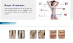808 nm Diode laser hair removal machine hotting selling