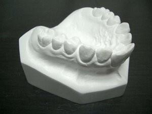 Wholesale Oral Surgery Teeth Alignment Correction White Stone Dental Teeth Study Model from china suppliers