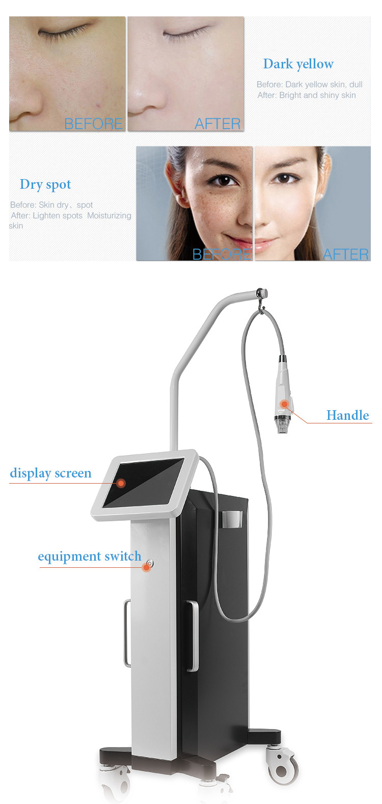 Micro Crystalline Beauty Skin Rejuvenation Machine Vertical RF Radio Frequency 240v