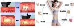 CE approved Chinese beauty device manufacture 808 diode laser hair removal