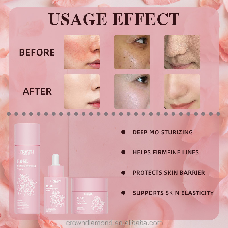 Private Label Niacinamide Brightening Anti Aging Wrinkles Retinol Cream Serum Rose Toner Facial Skin Care Set