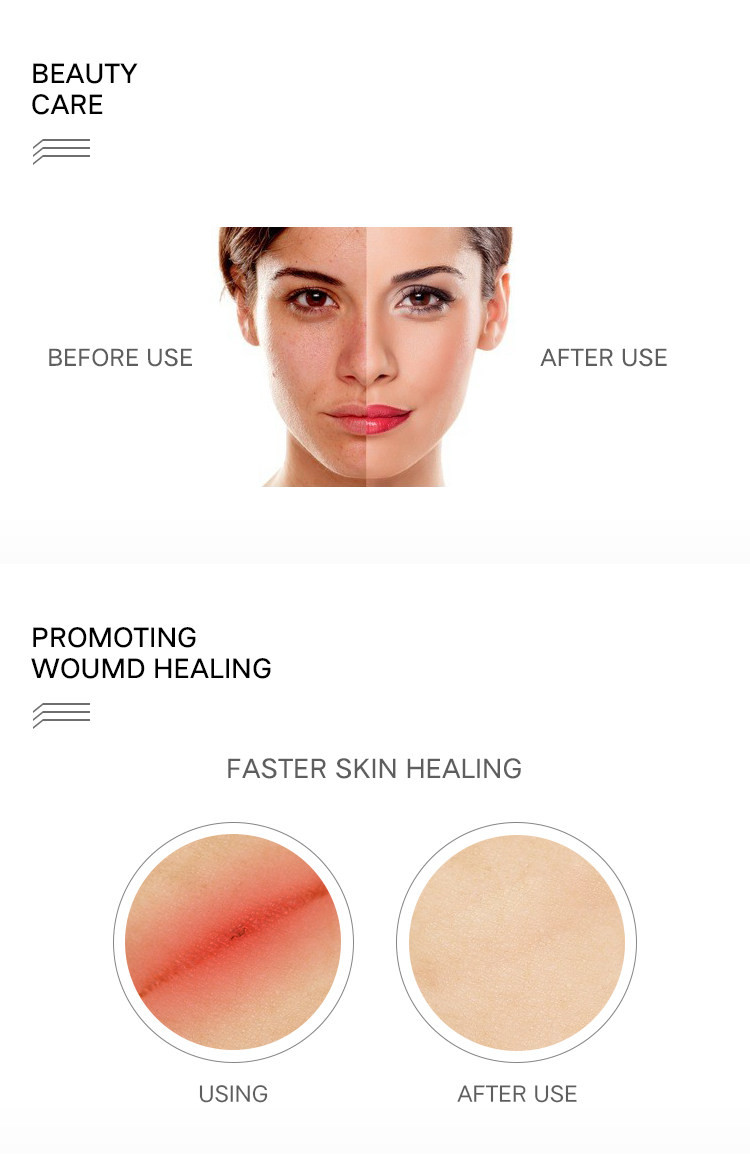 Collagen Skin Care Red Light PDT Machines 1500w 660nm Home Infrared