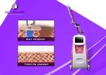 1064 / 532nm Q Switch Nd Yag Laser Tattoo Removal Machine Portable Style