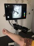 800 * 1280 Resolution Untouched Vein Locator Device 850nm Wavelength High